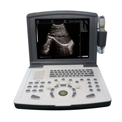 Scanner d'échographie de diagnostic numérique complet portable OEM