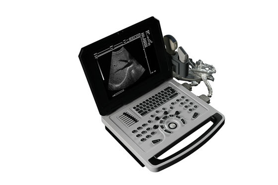 Carnet de notes Scanner à ultrasons noir et blanc pour la cardiologie