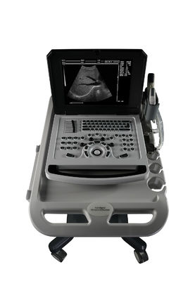 Carnet de notes Scanner à ultrasons noir et blanc pour la cardiologie